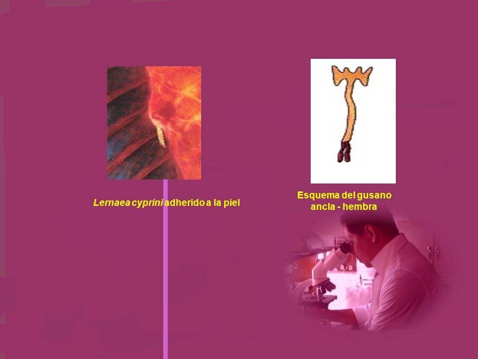 Que medicina dan a los conejos de las lombrices